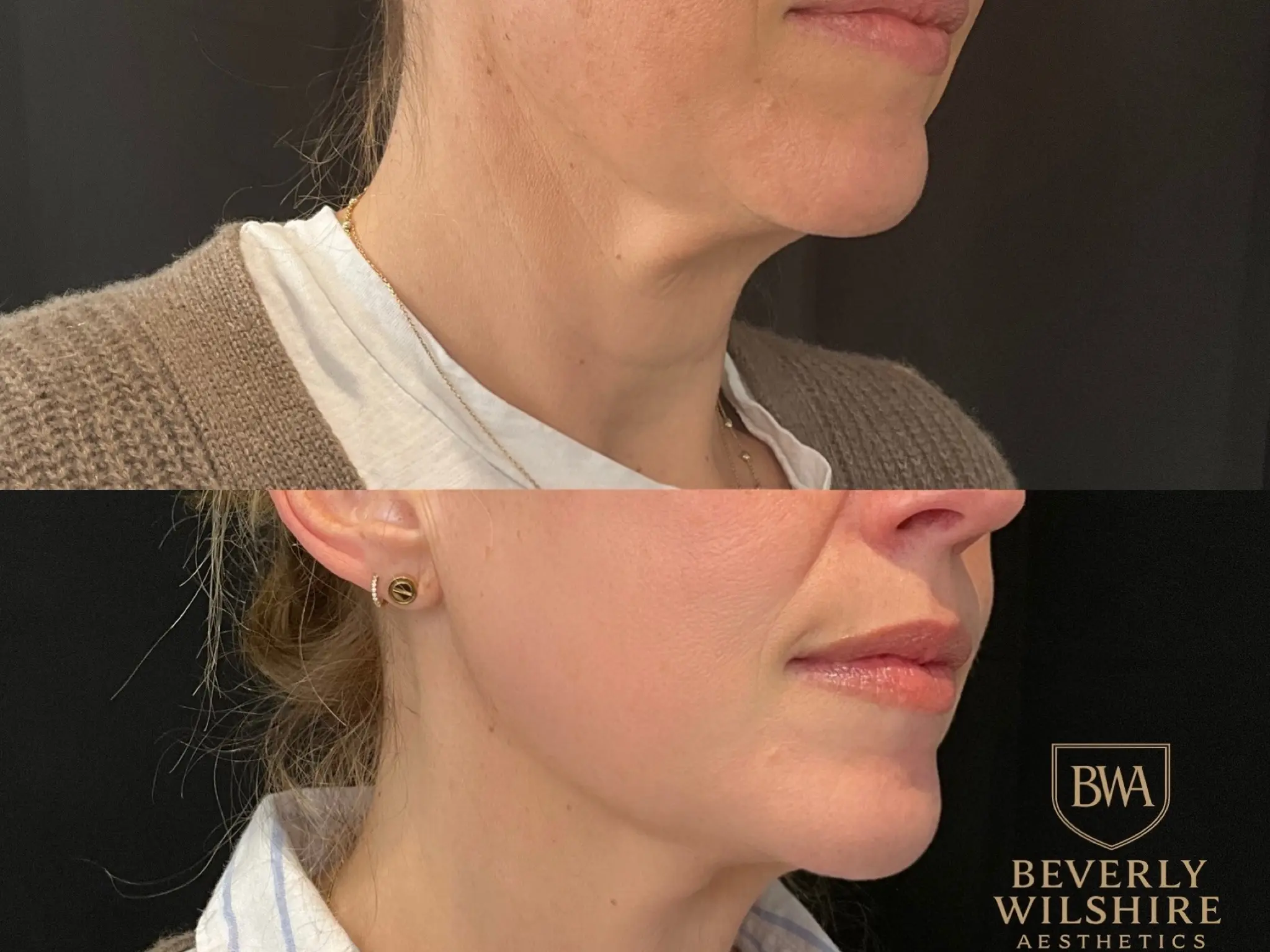 Beverly Wilshire Aesthetics
